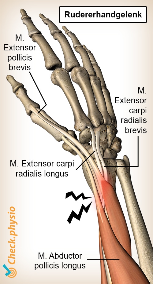 Arm Roeierspols Anatomie Extensor carpi radialis brevis longus Abductor pollicis