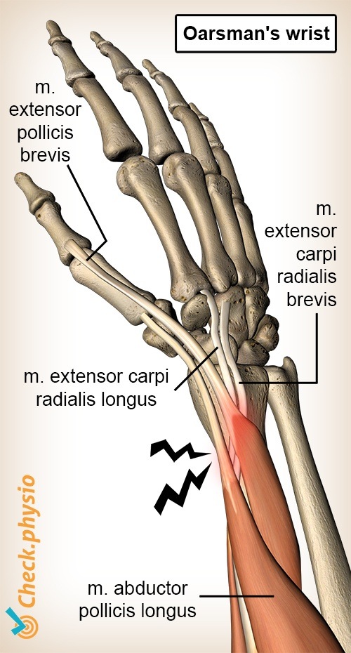 arm Rudererhandgelenk Anatomie Extensor carpi radialis brevis longus Abductor pollicis