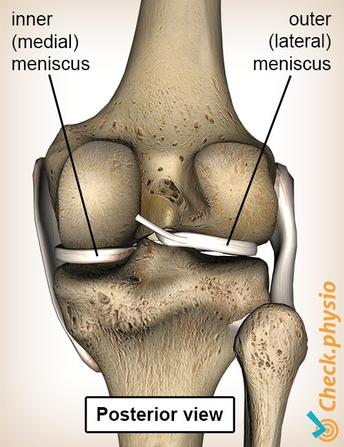 Knie Meniskus hinten