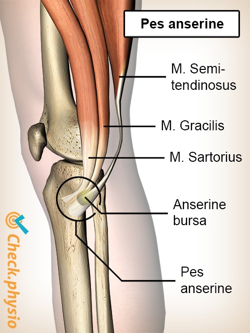 Knie Pes anserinus Schleimbeutel Bursa Sartorius Gracilis Semitendinosus Sehnen Gänsefuß Syndrom