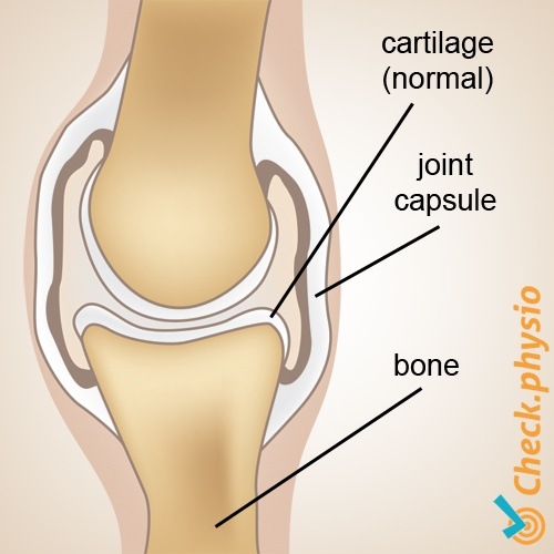 Arthrose Anatomie gesund