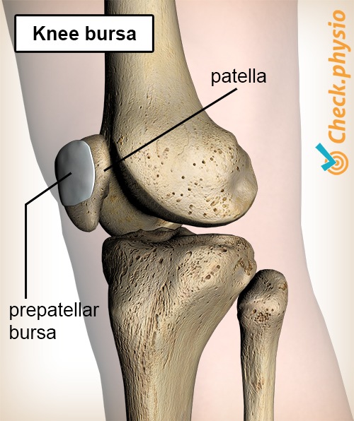 Knie Schleimbeutel Bursa Prepatellaris