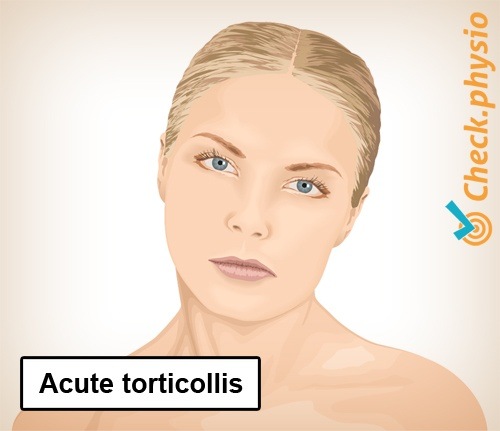 Nacken Torticollis abnorme Haltung