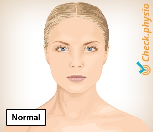 Nacken Torticollis normale Haltung