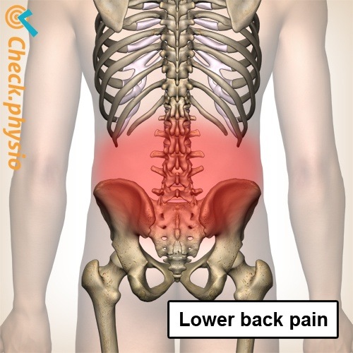 Rücken untere Rückenschmerzen Wirbelsäule Skelett