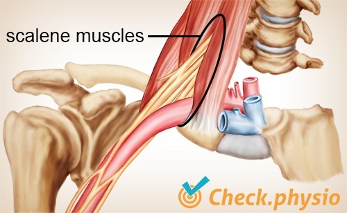 Schulter Arm Hand TOS Thoracic-Outlet-Syndrom Skalenusdreieck