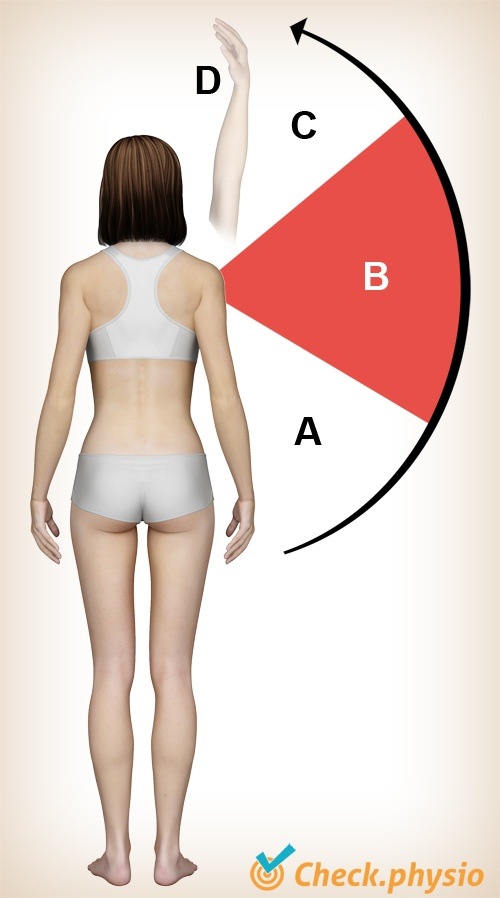 Schulter Impingement Painful Arc