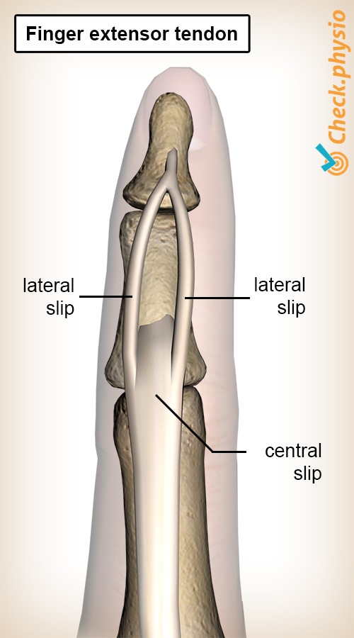 Finger Strecksehne Schlupf Zentralband Seitenband