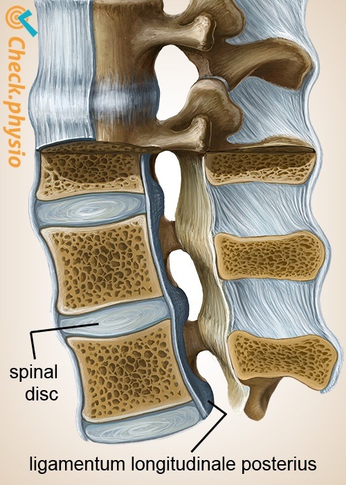 Wirbelsäule Ligamentum longitudinale posterius Zwischenwirbelscheibe Diskus