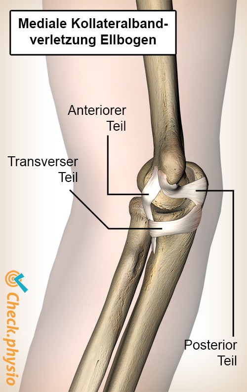 Ellenbogen mediales ulnäres Kollateralligament vorderer hinterer transversaler Teil