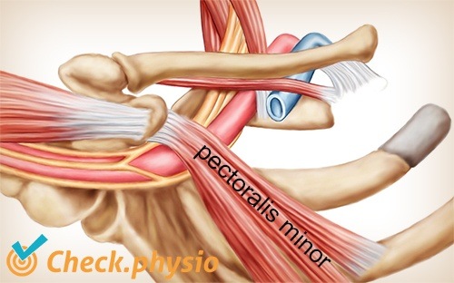 Schulter Arm Hand TOS Thoracic-Outlet-Syndrom Pectoralis minor