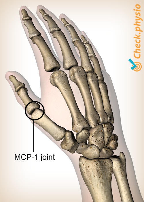 Hand MCP 1 Daumen