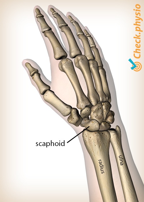 Hand Skaphoid