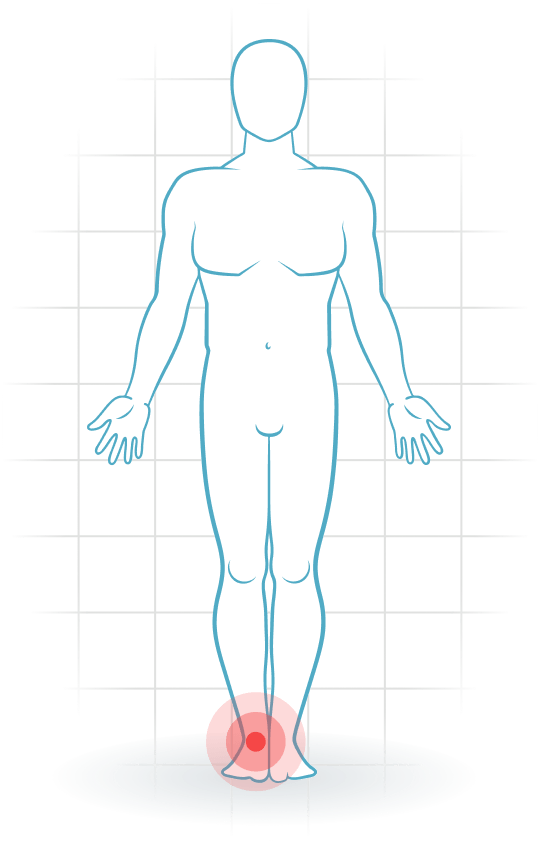 pijnlocatie Anteriore Sprunggelenk-Impingement