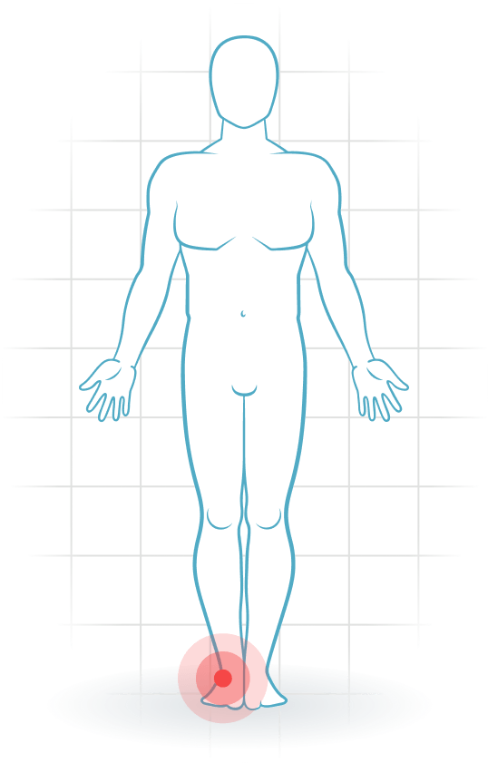 pijnlocatie Außenbandverletzung des Knöchels