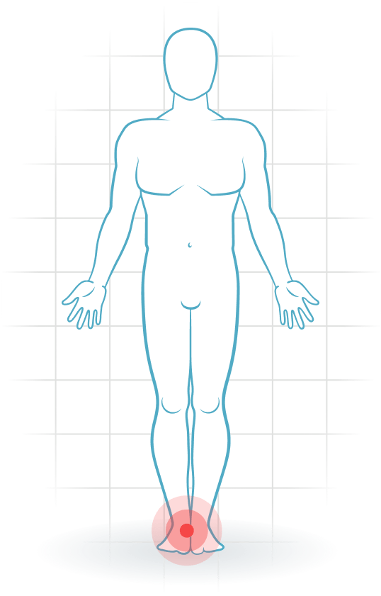 pijnlocatie Mediale Knöchelbandverletzung